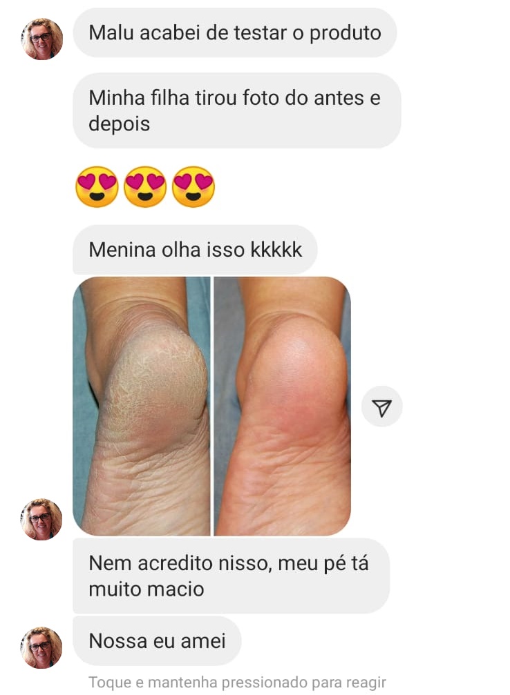 Antes e Depois - SpinLiss